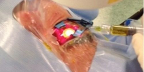 Crosslinking Accellerato