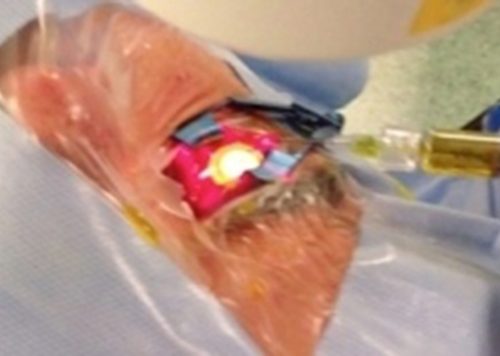 Crosslinking Accellerato Crosslinking Accellerato